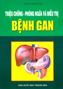 Triệu chứng – Phòng Ngừa Và Điều Trị Bệnh Gan