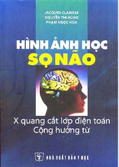 Hình Ảnh Học Sọ Não – X Quang Cắt Lớp Điện Toán Cộng Hưởng Từ