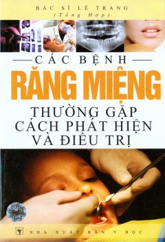 Các Bệnh Răng Miệng Thường Gặp Cách Phát Hiện Và Điều Trị