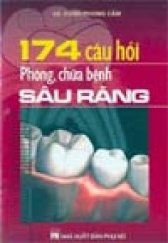 174 Câu hỏi phòng chữa bệnh sâu răng*