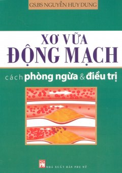 Xơ Vữa Động Mạch – Cách Phòng Ngừa & Điều Trị