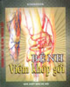 Bệnh Viêm Khớp Gối